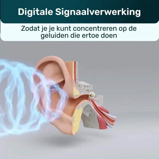 OmniHear image